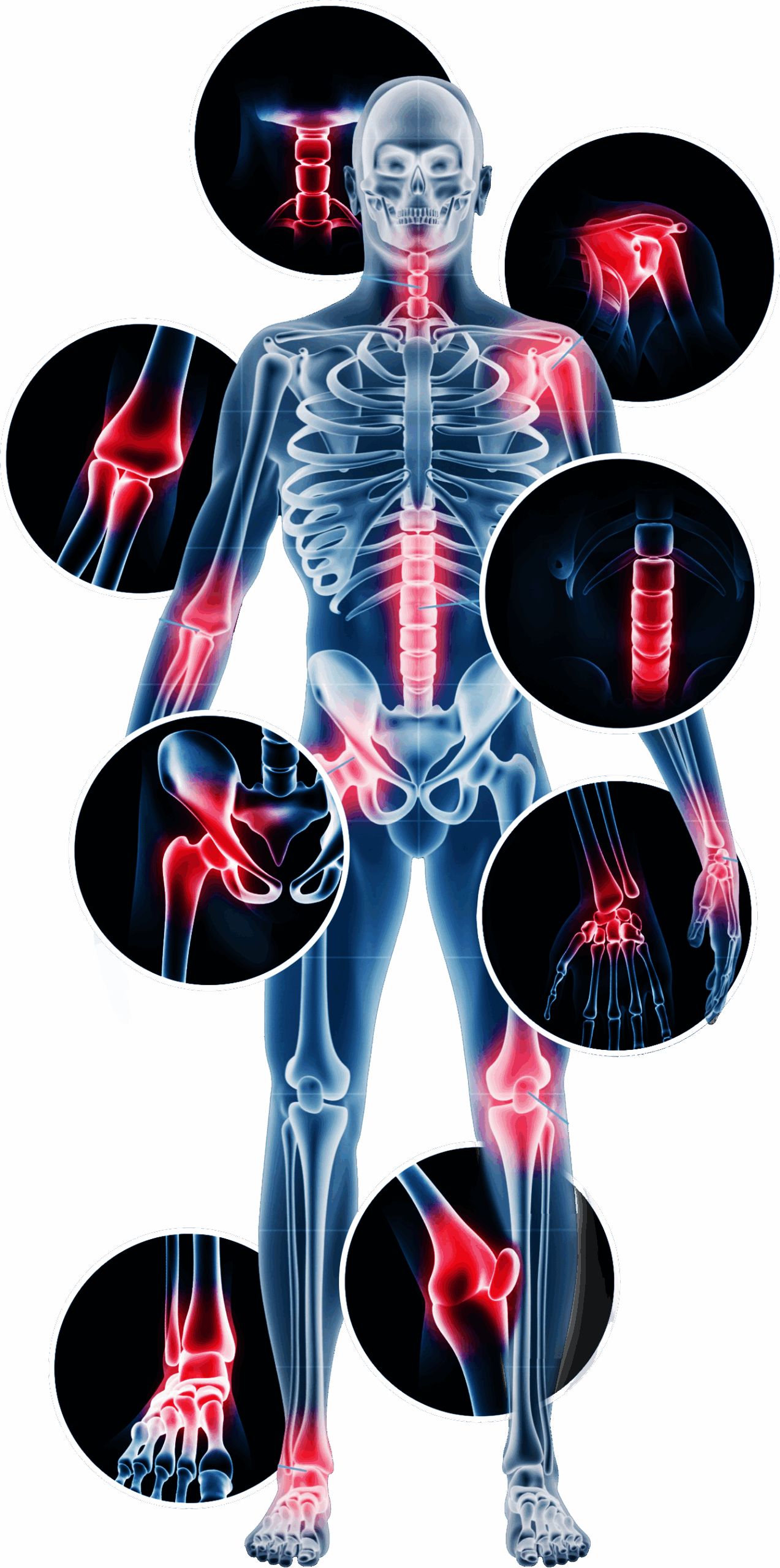 Treatment Areas