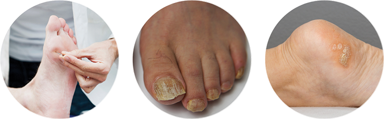 ADDITIONAL FOOT AND ANKLE TREATMENTS